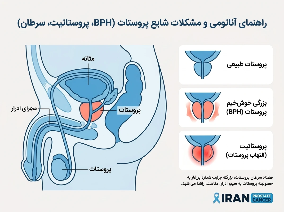 تصویر غده پروستات و بررسی خواص سیاه دانه و پروستات