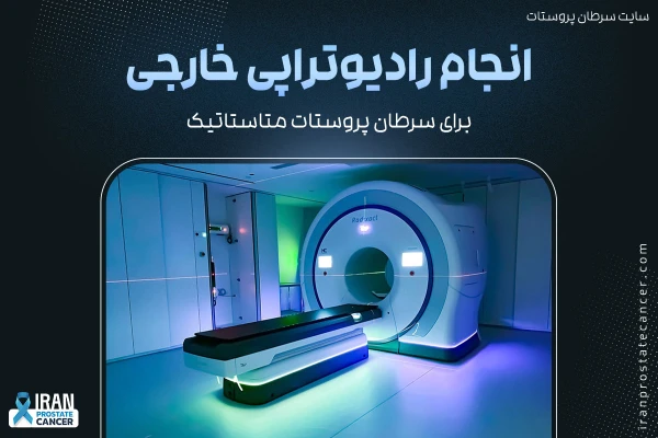 رادیوتراپی خارجی برای سرطان پروستات متاستاتیک