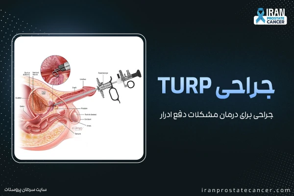 جراحی برای درمان مشکلات دفع ادرار (جراحی TURP)