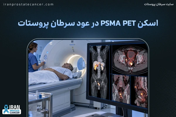 اسکن PSMA PET در عود سرطان پروستات