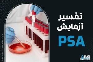 تفسیر نتایج آزمایش PSA