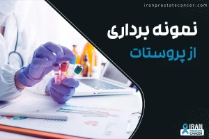 نمونه برداری از پروستات