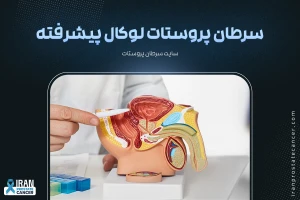 سرطان پروستات لوکال پیشرفته