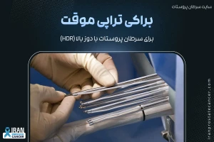 براکی تراپی موقت