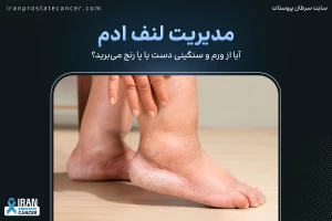 لنف ادم